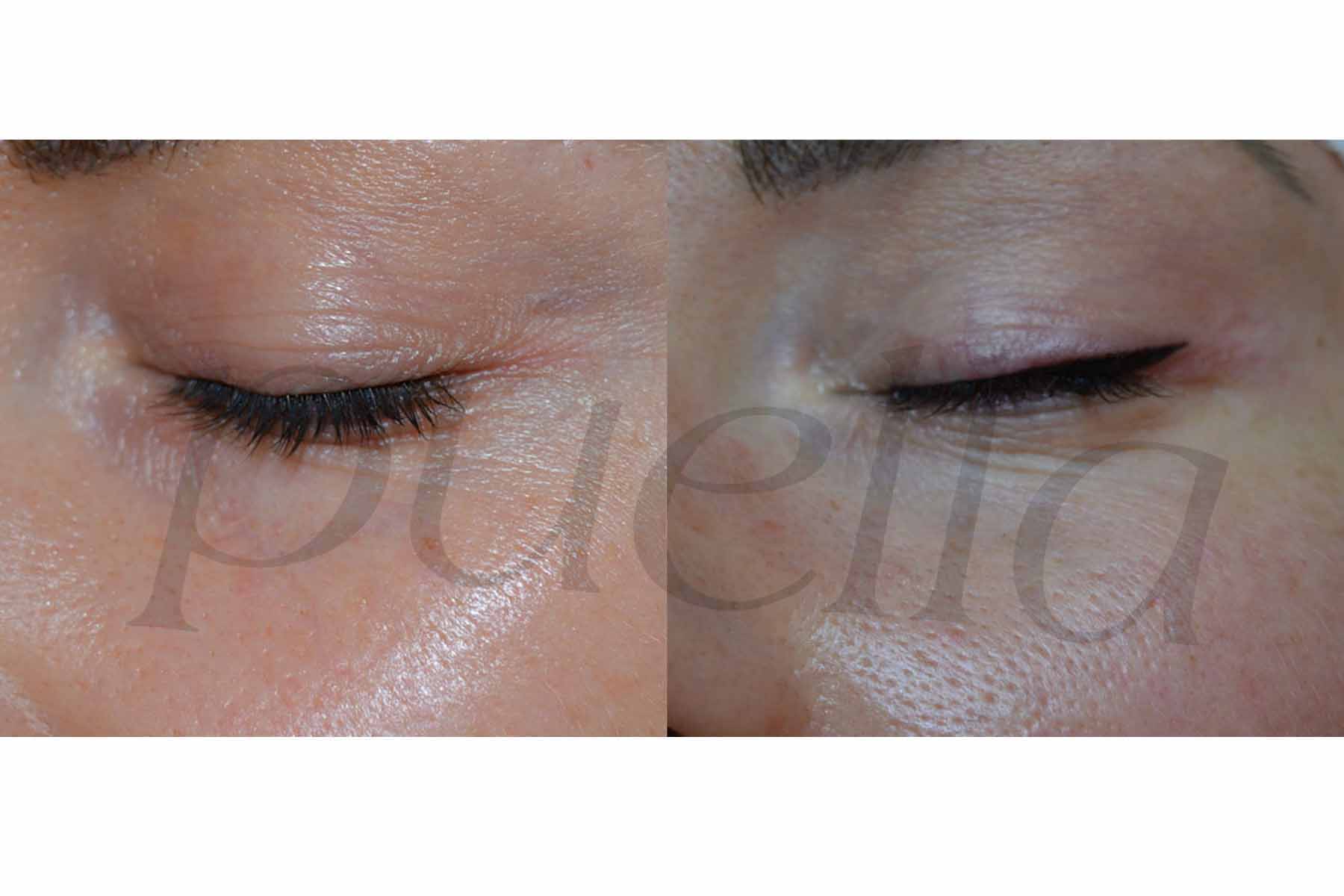 Permanent makeup by Puella Beauty - eyeliner
