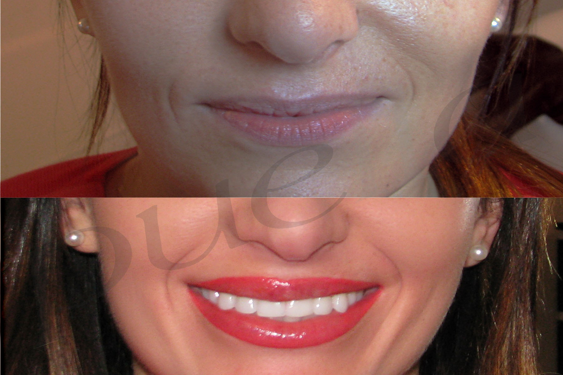 Permanent makeup by Puella Beauty - lips before and after image