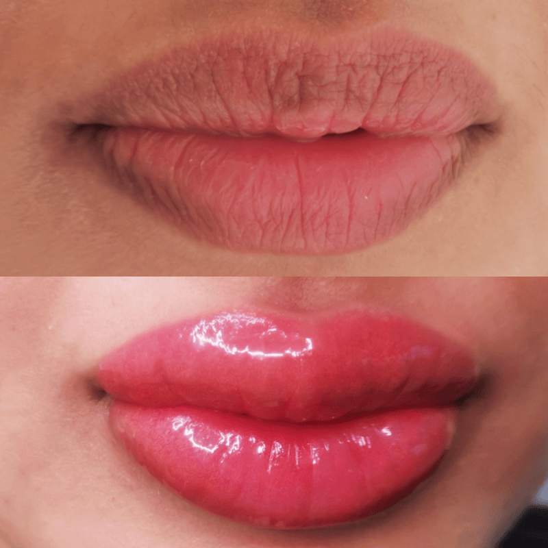 lips_colour_neutralisation